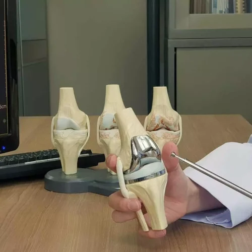 Knee Implant Prices Under Fresh Review: NPPA Weighs 10% Hike Request from Manufacturers