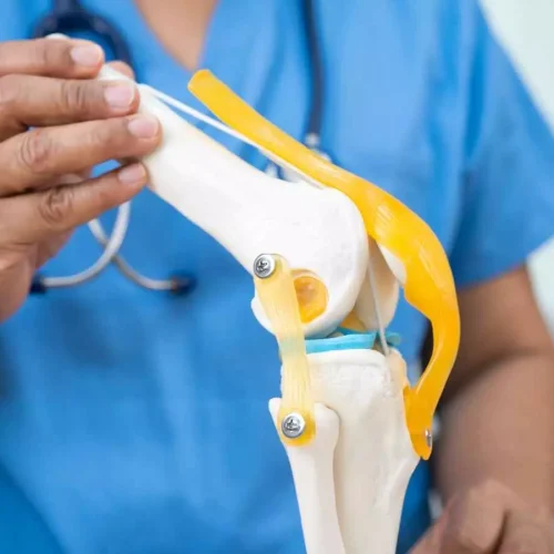 Diacerein Ineffective for Knee Pain in Osteoarthritis with Effusion-Synovitis: JAMA