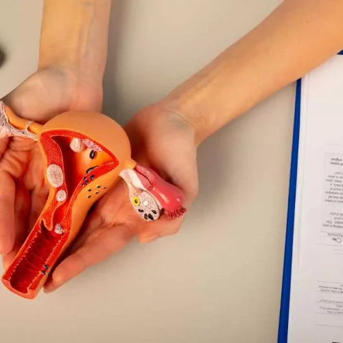 Opportunistic Salpingectomy May Reduce Risk of Tubo-Ovarian Carcinoma, Finds JAMA Research