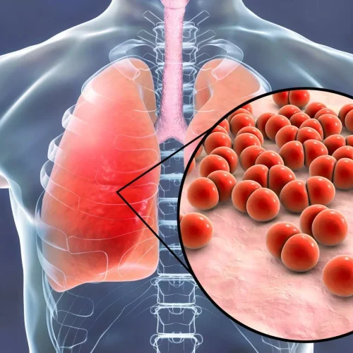 Tetracyclines Reduce Fever and Hospital Stay in Mycoplasma pneumoniae Patients: Study