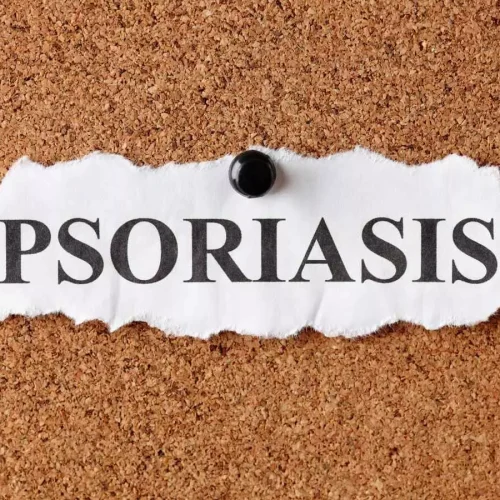Antibiotic Use May Reduce Biologic Treatment Persistence in Psoriasis: JAMA