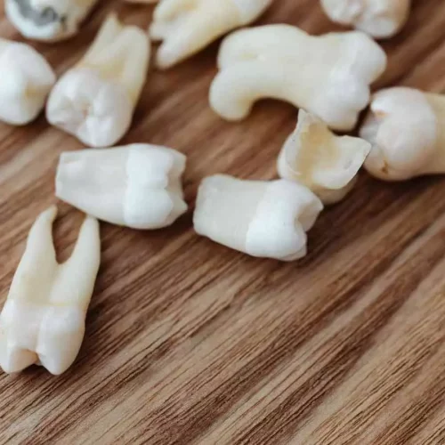 Adenoid Hypertrophy Linked to Delayed Dental Development but Not Skeletal Growth in Children: Study