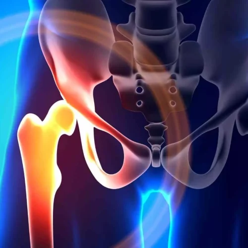 Anesthesiologist-Led Care Speeds Hip-Fracture Surgery and Reduces Complications: Study