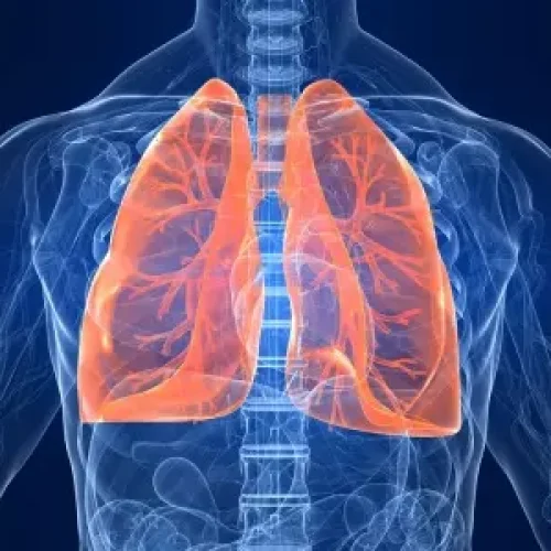Iron-deficient diet prevents lung cells from fighting the flu: Study