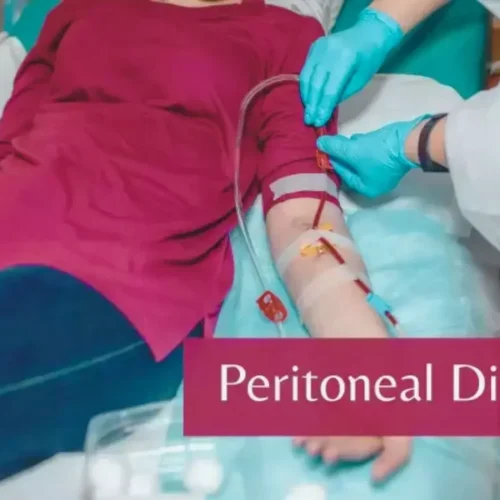 Dyslipidemia in CKD: Beyond Glucose Absorption in Peritoneal Dialysis, suggests study