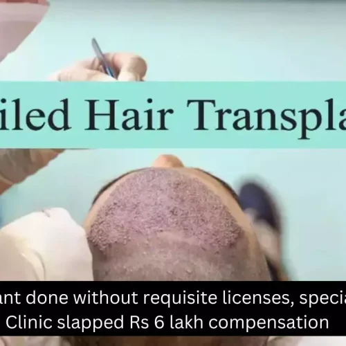Hair transplant done without requisite licenses, specialists: Delhi Clinic ordered to pay Rs 6 lakh compensation