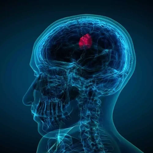 Nasal drops fight brain tumors noninvasively,  states study