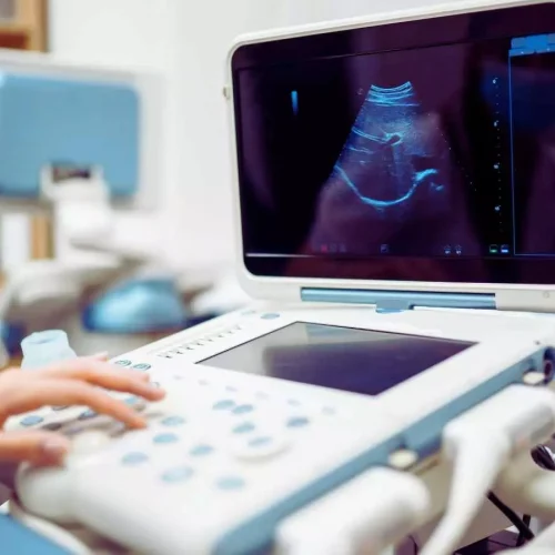 First impressions count: How babies are talked about during ultrasounds impacts parent perceptions, caregiving relationship