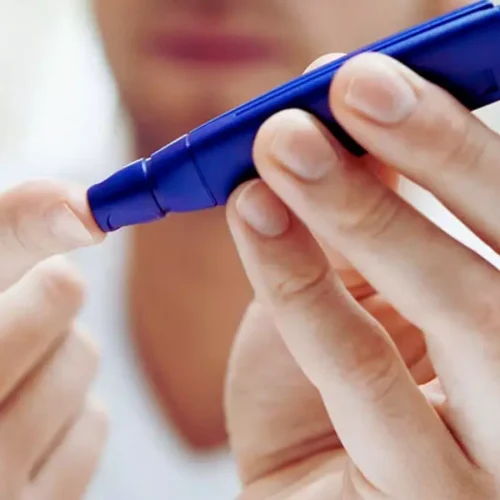 Young-Onset Diabetes Tied to Beta Cell Deficiency, Not Obesity: PHENOEINDY-2 Study