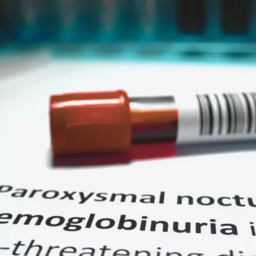 Rare Blood Disorder Leads to Severe Kidney Damage in Untreated PNH: Case Report