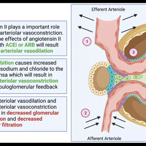 Lower Irisin Levels Linked to Diabetic Nephropathy Progression in T2DM: Study