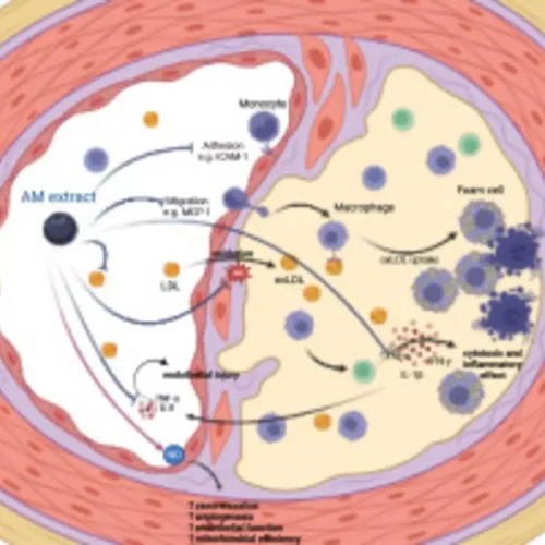 Aronia Extract Improves Cardiovascular Health and Reduces Inflammation in Elderly with Metabolic syndrome: Study