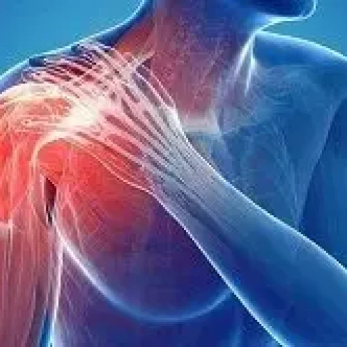 Managing irreparable rotator cuff tears requires comprehensive approaches to improve patient outcomes: study