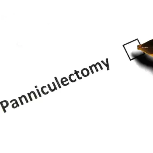 COVID may increase risk of dangerous blood clots after panniculectomy: Study