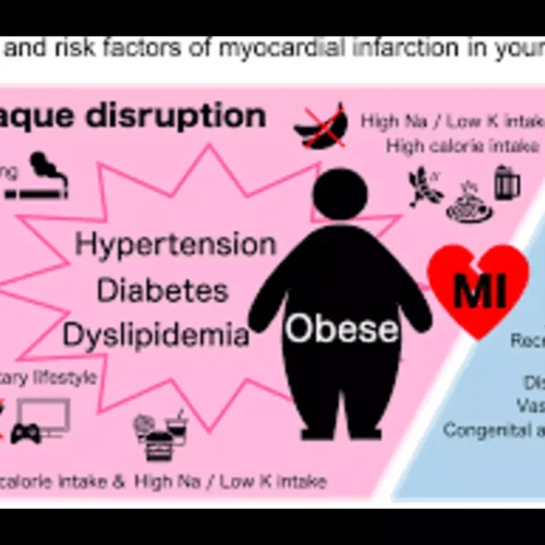 Abnormal Free Fatty Acids Amplify Long-Term Cardiovascular Risk in Premature MI: Study