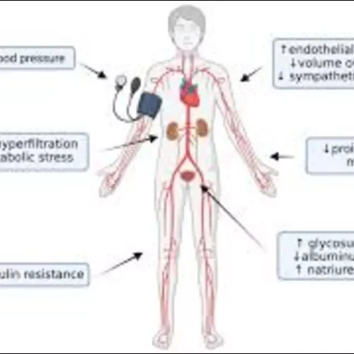 SGLT2 Inhibitors Provide Broad Benefits in Kidney Outcomes Across Diabetes Status and UACR Levels: JAMA