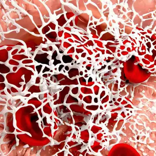 Effectiveness of anti-clotting meds after stent placement varied in people with diabetes: Study