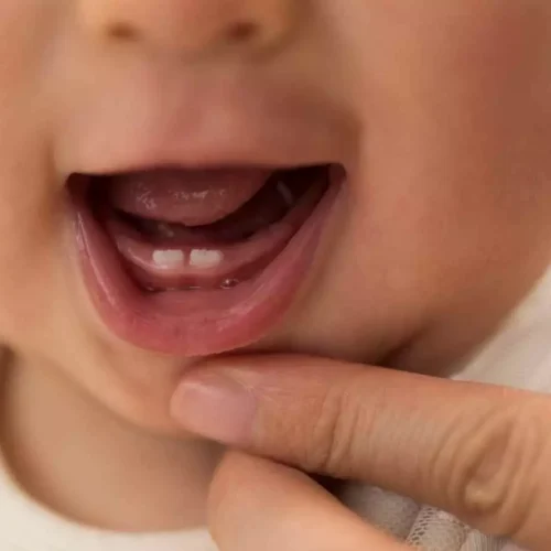 Teeth of babies of stressed mothers come out earlier, suggests study