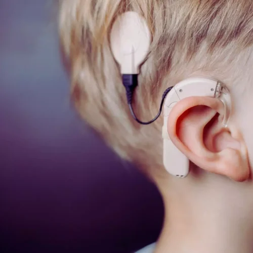 Musical Training Enhances Auditory Rehabilitation in Children with Cochlear Implants: Study