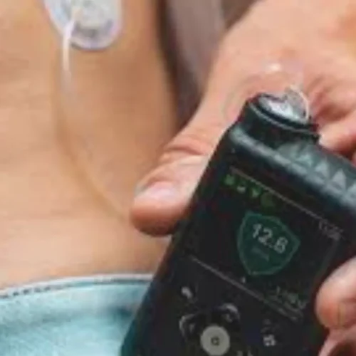 Prompt Responses to Smart Pen Alerts Improve Time in Range in Adults With T1D: Study