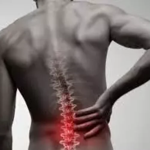 Double Index Screw Fixation Improves Radiological Outcomes in Thoracolumbar Burst Fractures: Study