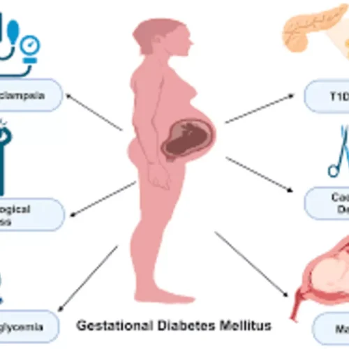 Probiotics in Pregnancy: Reduced GDM Risk but Increased Preeclampsia and Gestational Age: Study