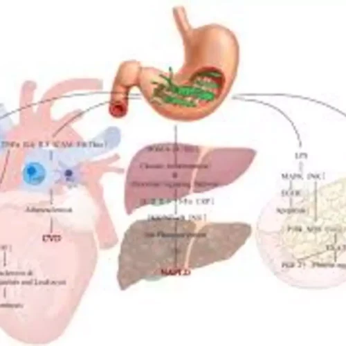 H. pylori Infection Linked to Elevated remnant cholesterol Levels via Insulin Resistance and Inflammation: Study