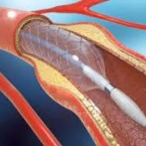 Oral Hydration Safe and Effective Alternative to IV Hydration for contrast-induced nephropathy Prevention: Study