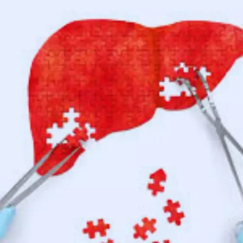 Thermal Ablation Shows Near-Zero Mortality in Liver Tumors,  finds research