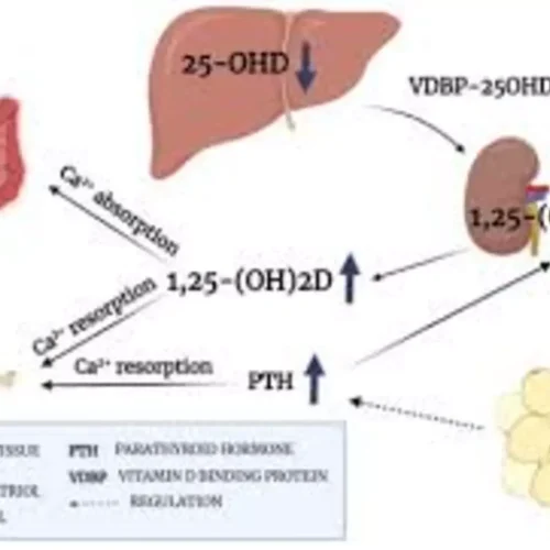 Preoperative Vitamin D May Reduce Hypocalcemia After Parathyroidectomy, suggests study