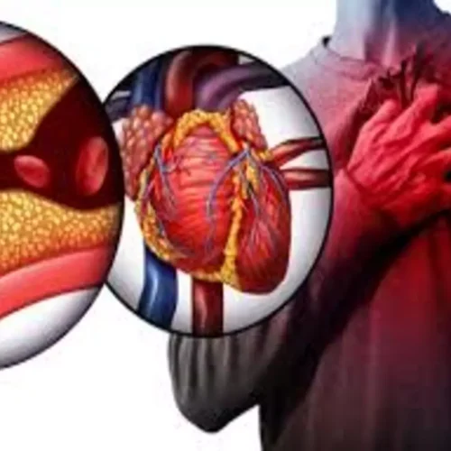 Haemoglobin Systolic Pressure Index Better Predicts CV Risk Than HbA1c or SBP Alone: Study