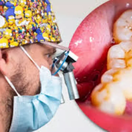 Magnification Loupes Improve Accuracy and Outcomes in Root Canal Treatment: Study